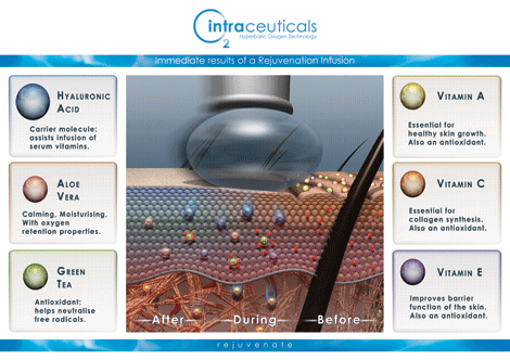 Intraceuticals